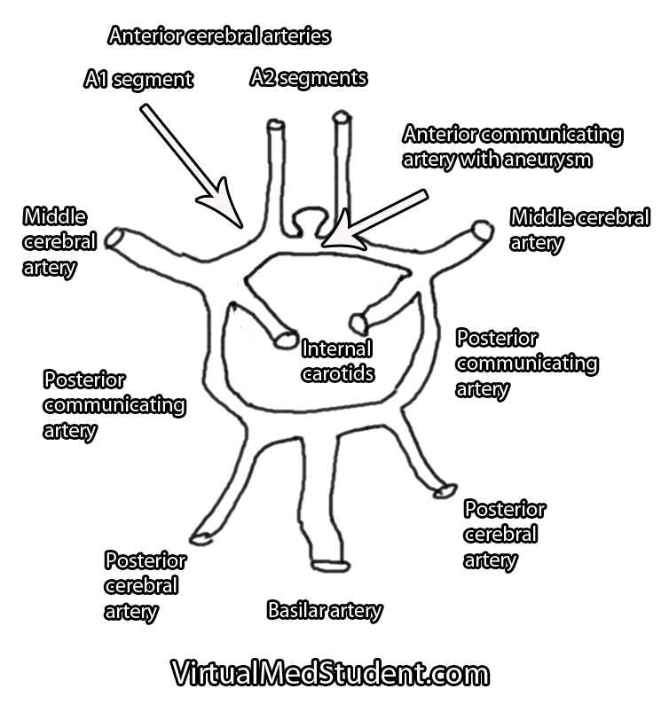 icd 10 code for saccular aneurysm anterior communicating artery