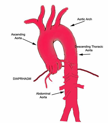 Aorta Schematic