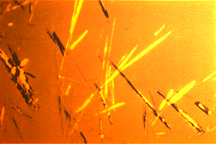 Gout Crystals